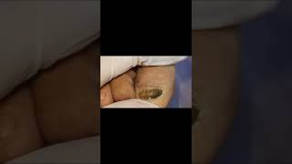 Pedicure tutorial Complete onychomycosis cle [upl. by Atiuqad131]