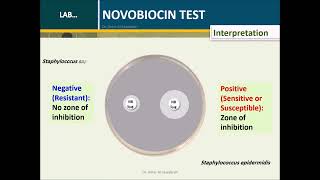 Novobiocin test Coagulase Negative Staphylococci S epidermidis and S saprophyticus [upl. by Itnava491]