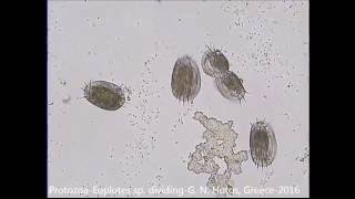 ProtozoaCiliatesEuplotes sp dividingDr G HOTOS Lab GREECE [upl. by Crotty]