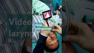 Video laryngoscope Procedure I love India hospital and all peoples ultrasoundcentre lithotripsy [upl. by Neiviv570]