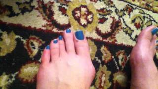 My Moms Cramp Toe [upl. by Atirihs]