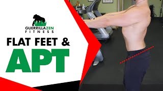 Anterior Pelvic Tilt Correction  Flat Feet Exercises [upl. by Olihs]