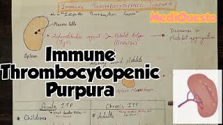 Immune Thrombocytopenic Purpura PlateletDisorders Hematology RobbinsPathology [upl. by Rayburn878]