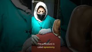 Episiotomy sciessor Part1 doctor delivery hospital nursingexperts pregnancy nursingstudents [upl. by Suoivatco756]