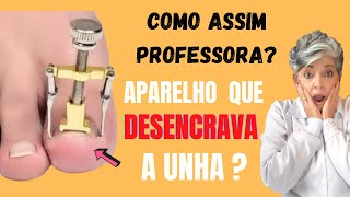 Aparelho que Desencrava a Unha Como Assim Professora [upl. by Renba]