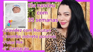 Minha filha nasceu com 35 semanas gravidez com Rocutan coombs indireto fator RH [upl. by Anuska]