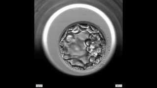 EmbryoScope Embryo Development  Blastocyst [upl. by Ingunna]