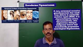 XERODERMA PIGMENTOSUM SAM BIOLOGY 🧫 CLASS [upl. by Ahselaf]