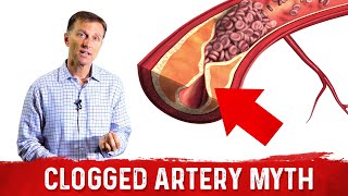 The Clogged Artery Myth – Dr Berg [upl. by Dyraj]