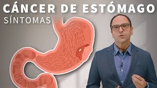 Cáncer de estómago Quien esta en riesgo y cuales son los sintomas [upl. by Pell]