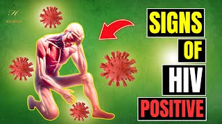 10 Signs of Hiv Positive Man [upl. by Giulio83]