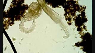 Cercaria parasite larval trematode [upl. by Aikenat340]