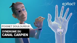 Syndrome du Canal Carpien  Explications – EPITACT [upl. by Hak993]