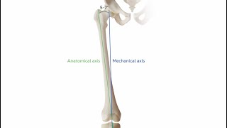 Total knee arthroplasty preview [upl. by Aros]