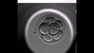 Blastocyst Video  Science at Boston IVF [upl. by Euqram982]