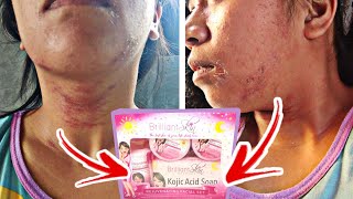 BRILLIANT SKIN REJUVENATING SET  HONEST REVIEW Ep 1 [upl. by Varrian]