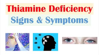 Thiamine Vit B1 Deficiency Signs amp Symptoms amp Why They Occur [upl. by Gwynne582]