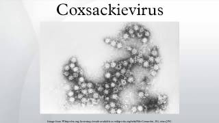 Coxsackievirus [upl. by Namurt]