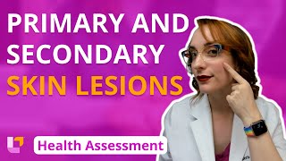 Primary amp Secondary Lesions  Health Assessment for Nursing Students  LevelUpRN [upl. by Charita386]