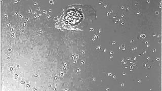 Mannose blocks phagocytosis of the Vibrio anguillarum Δwzt mutant [upl. by Toombs]