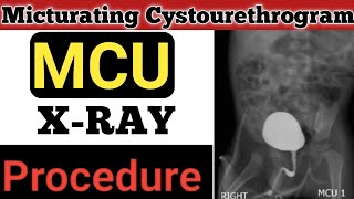 MCU procedure micturating Cystourethrogram  Urinary tract imaging  ashutoshsingh [upl. by Llehcal784]