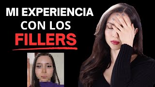 Mi Experiencia CON FILLERS NO lo Hagas sin antes ver esto [upl. by Shutz]