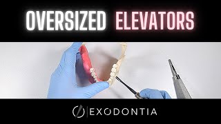 Another Approach To Elevating Teeth  OnlineExodontiacom [upl. by Seilenna]