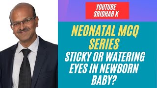 Sticky eyes in babies Nasolacrimal duct obstruction in babies Watering eyes in babies MCQ baby [upl. by Pachton370]