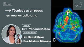 Técnicas avanzadas en neurorradiología por la Dra Yohana Mateo [upl. by Neliac]