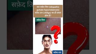 सफ़ेद तिल और सफ़ेद दाग़ में फर्क Idiopathic Guttate Hypomelanosis amp Vitiligo igh vitiligo leucoderma [upl. by Matheson30]