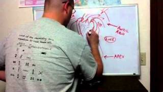 ECG Manifestations of ACS II [upl. by Yddub]