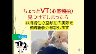 ちょっとVTを見つけてしまったら非持続性心室頻拍の実際を循環器内科医が解説します [upl. by Otanod]