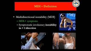 MDI Multidirectional instability shoulder dislocation ข้อไหล่หลด รศนพบัญขา ชื่นชูจิตต์ Bancha C [upl. by Alodie]