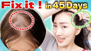 Scalp Lymphatic Drainage Massage to Improve Thinning Hair in 45 Days [upl. by Bradski]