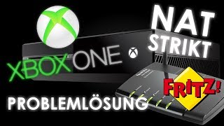 Xbox One  NAT Probleme beheben  Telnet Lösung  Fritz Box [upl. by Schertz]