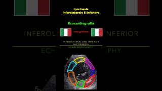 Ecocardiografia  Ipocinesia Inferolaterale E Inferiore [upl. by Selinski]