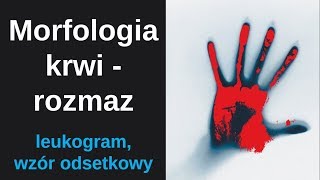 Morfologia krwi  rozmaz automatyczny lub ręczny  leukogram [upl. by Hole]