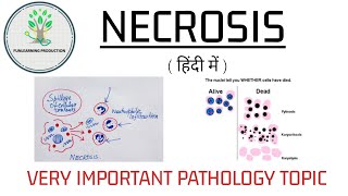 Necrosis amp its Types  Cell injury Part2 [upl. by Ainos848]