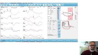 Introduction to the Audera Pro [upl. by Lorn]