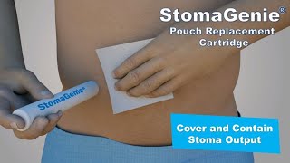 StomaGenie cartridge covers and contains stoma output during ostomy pouch changes [upl. by Egor]