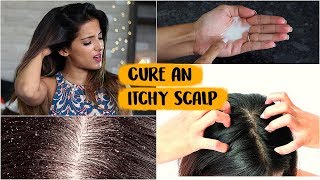 6 WINTER Haircare Hacks To Get Rid Of An Itchy Scalp Naturally At Home Tips amp Tricks [upl. by Ealasaid]