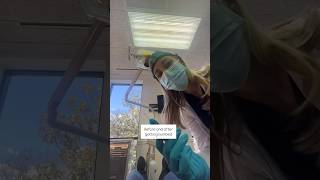 What it feels like to get numbed before a gum procedure [upl. by Intirb]