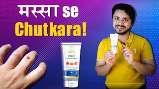 Review  7 Days Wart Removal Cream  मस्सा kaise nikale [upl. by Eiba]