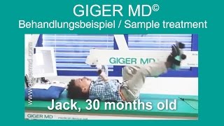 GIGER MD® neurophysiological therapy  Sample treatment [upl. by Furey]