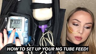 How to Set Up Your NG Tube Feed Kristy J [upl. by Pachton]