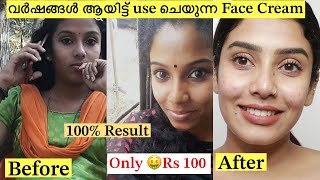 💯Result Best skin Brightening Cream 🧴❌No Side Effects 😎glamyganga [upl. by Refynnej]