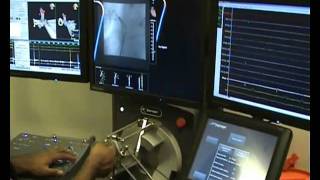 Experience of robotic catheter ablation in humans using a novel remotely steerable catheter sheath [upl. by Nirot]