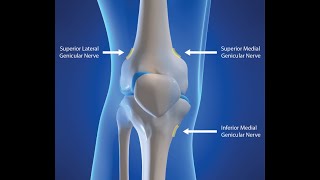 GENICULAR NERVE BLOCK [upl. by Ativet]