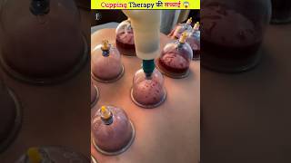 Secret of cupping therapy [upl. by Eltotsira]