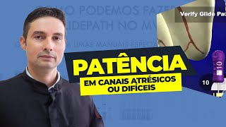 Patência em Endodontia [upl. by Dam]